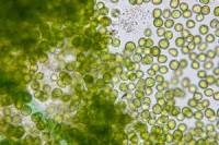 vue d'un microscope sur micro organismes
